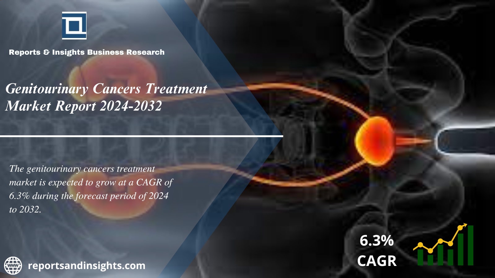 Genitourinary Cancers Treatment Market Share, Price Trends, Size, Industry Analysis Report and Forecast 2024 to 2032