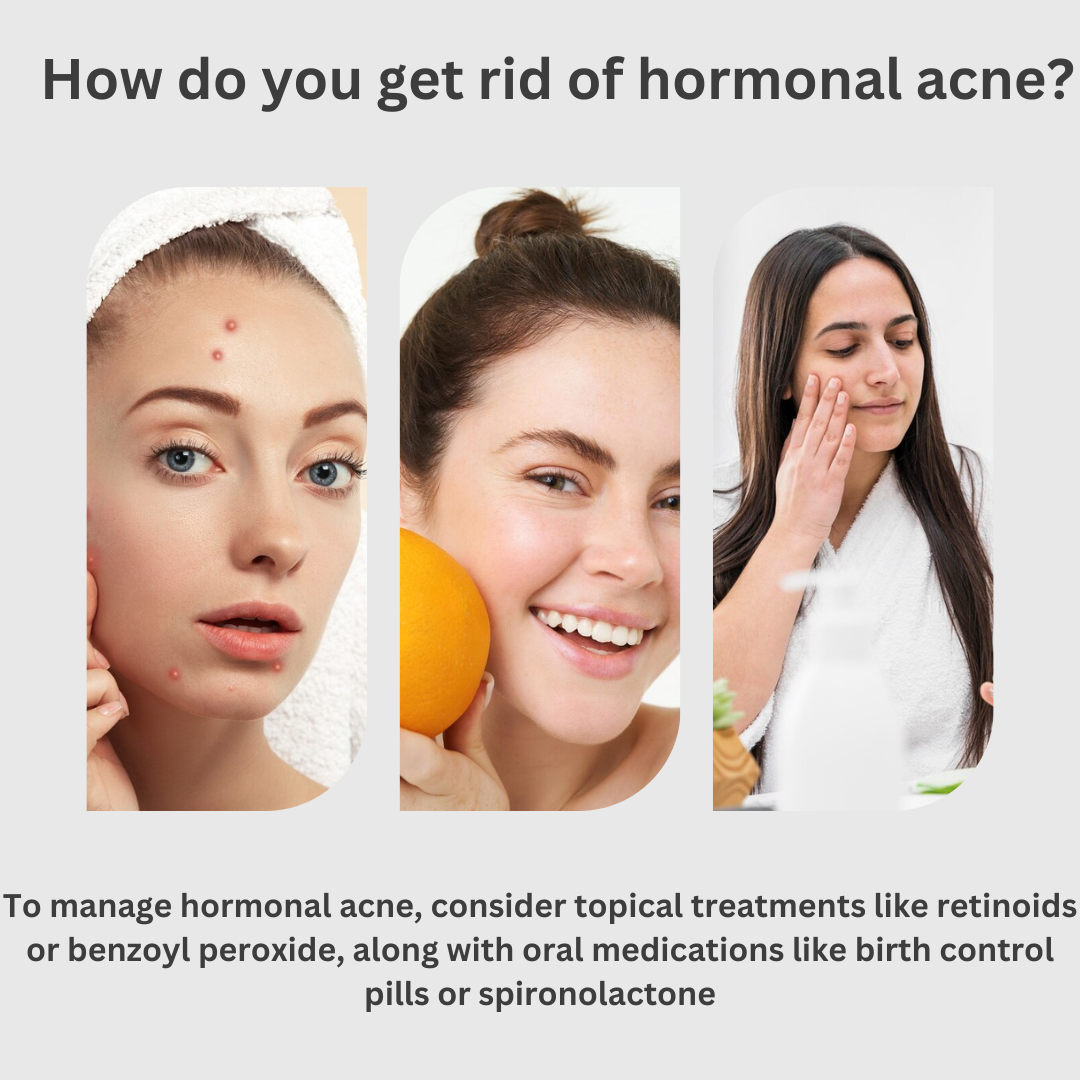 How long does it take for Accutane to work on hormonal acne?