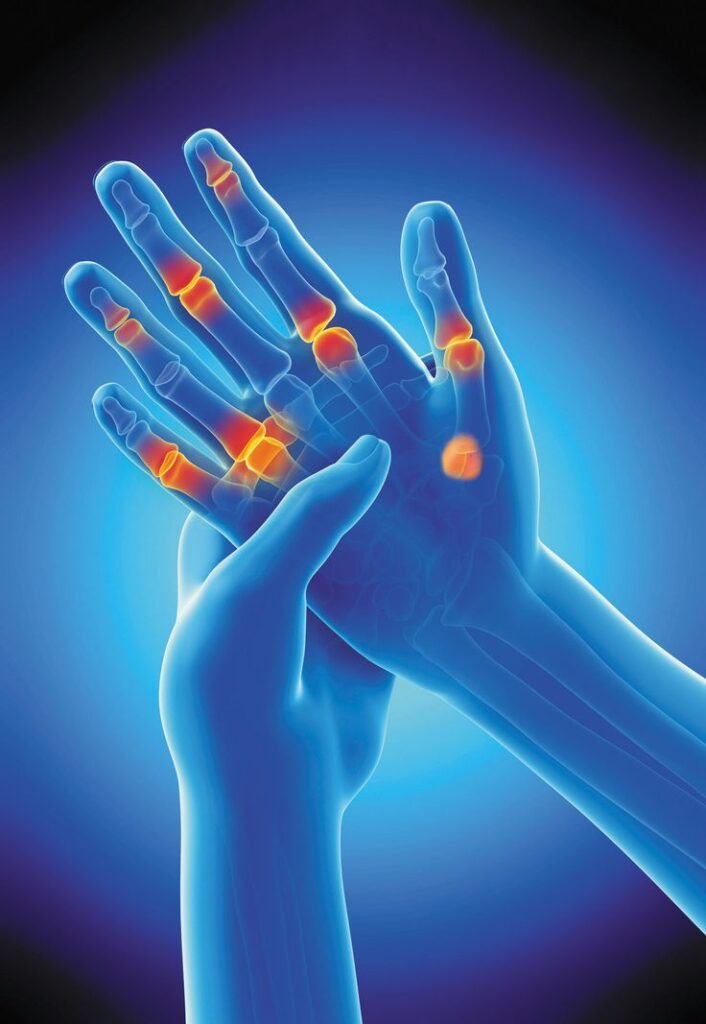 15 Types of Finger Pain, Their Causes, Diagnosis, and Treatment ...